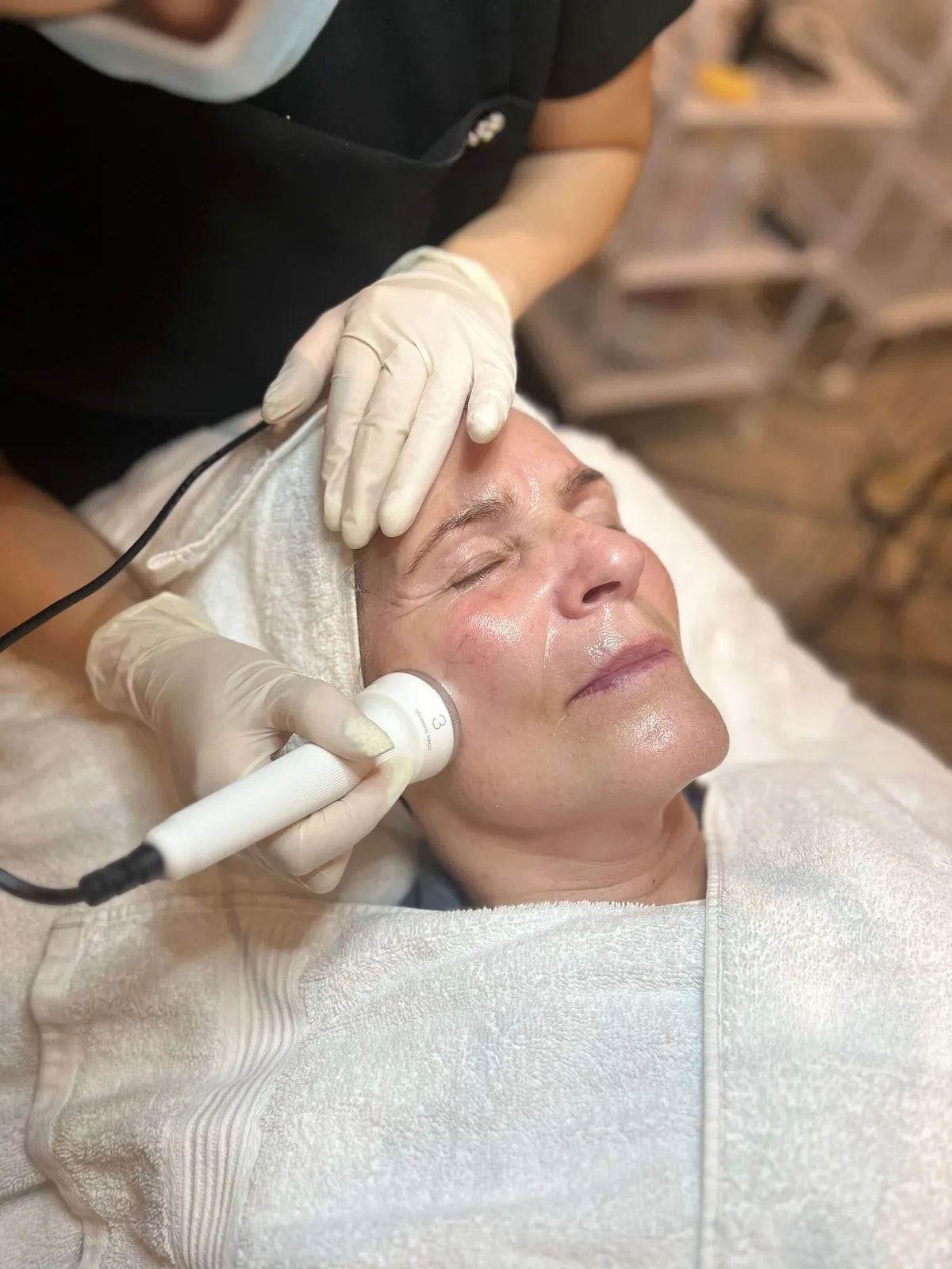 Ansigtsbehandling_Diamantpeeling_Beauty_By_Newgard_Kosmetolog_Ikast
